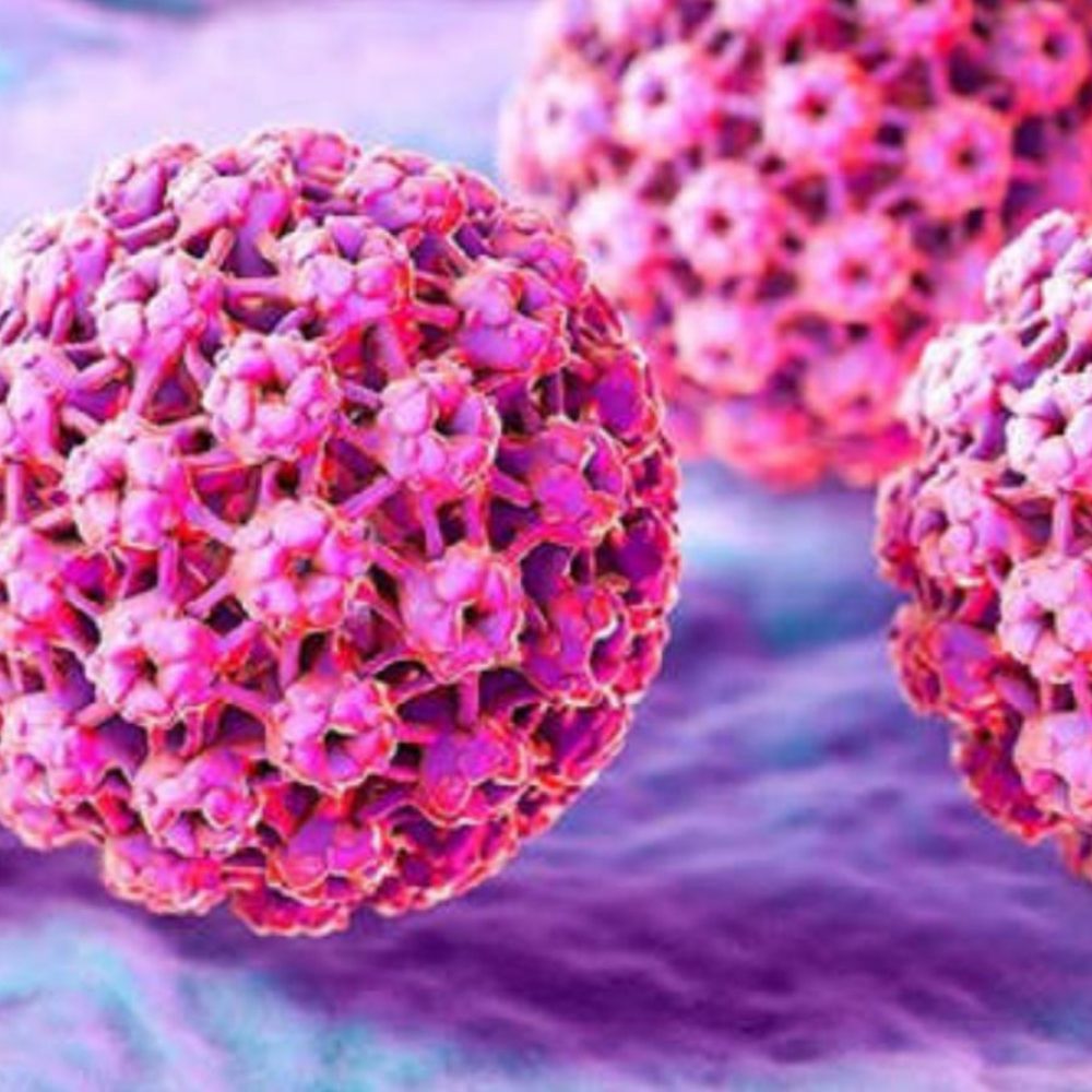 virus papiloma humano
